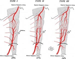 La vascularisation épigastrique supérieure et inférieure Anastomoses variables dans le muscle grand droit